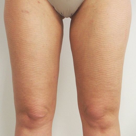 Image after
