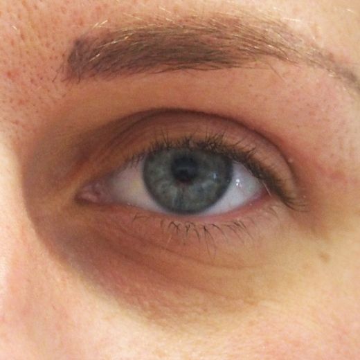 Image after