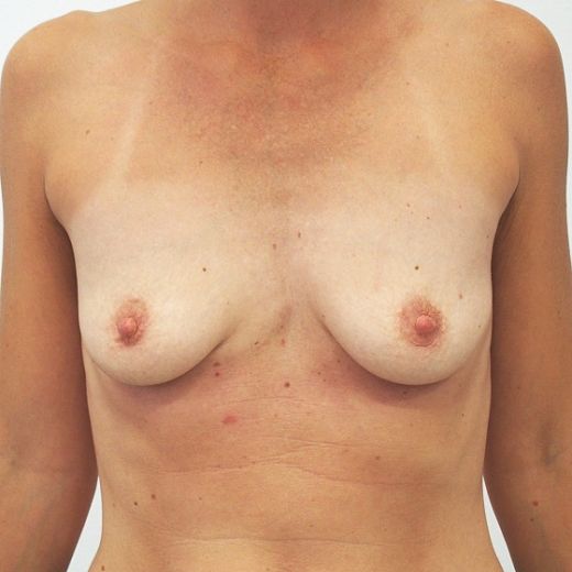 Image before