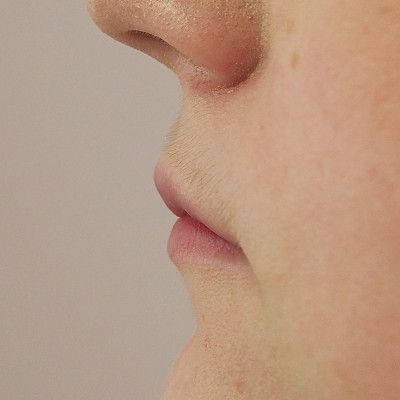 Image before