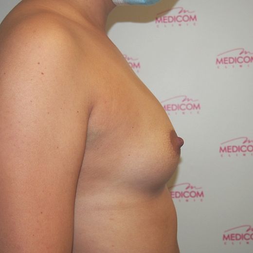Image before