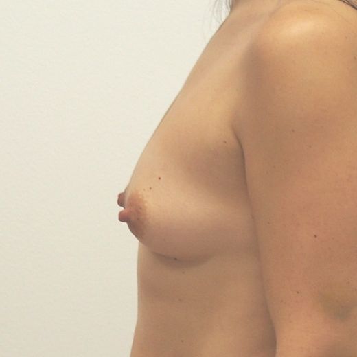 Image before
