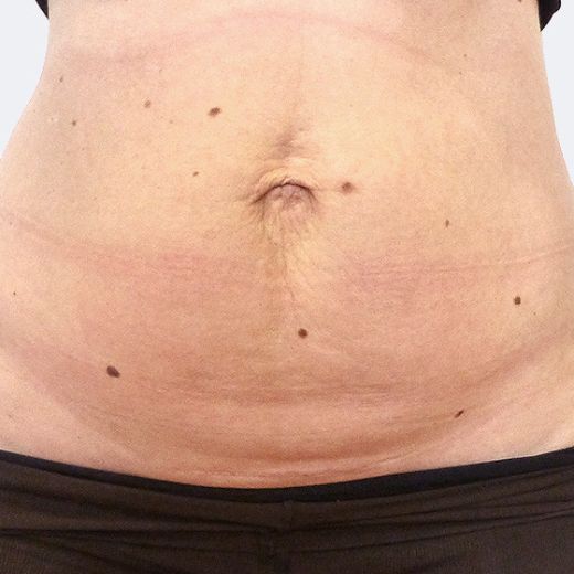 Image before