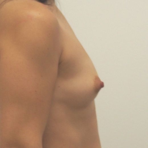 Image before
