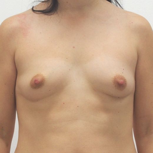 Image before