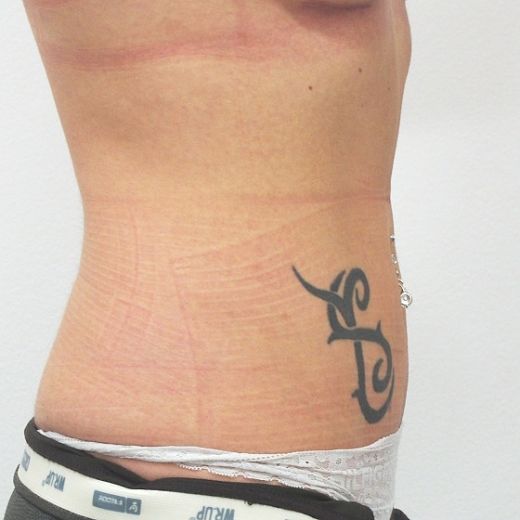 Image after
