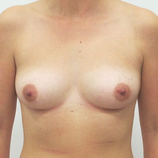 Image before