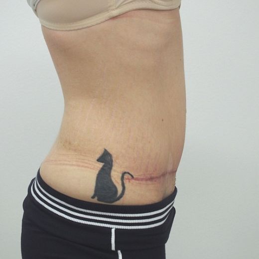 Image after