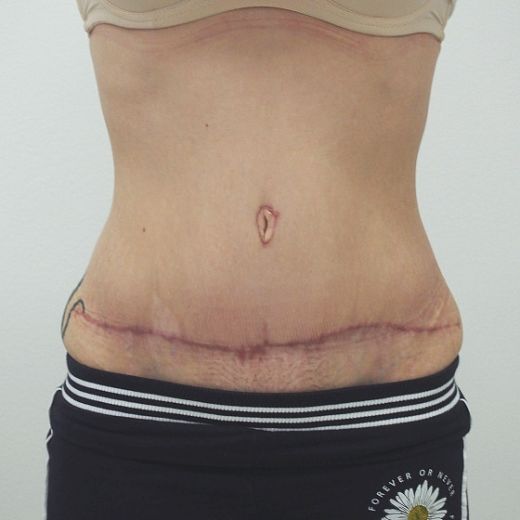 Image after