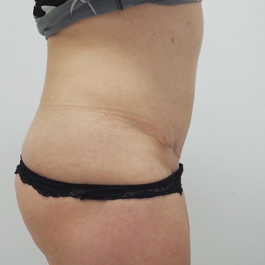 Image after