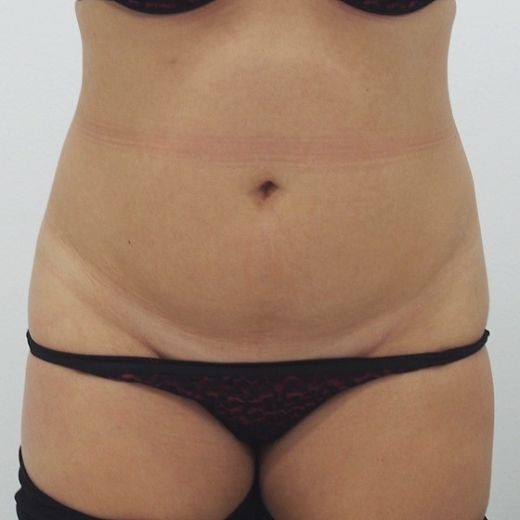 Image before