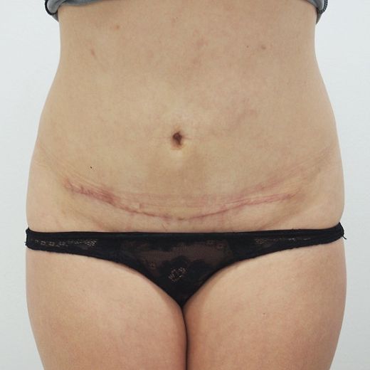 Image after
