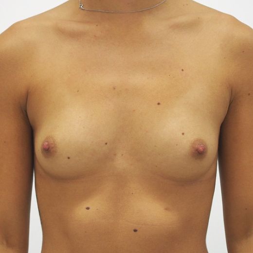 Image before