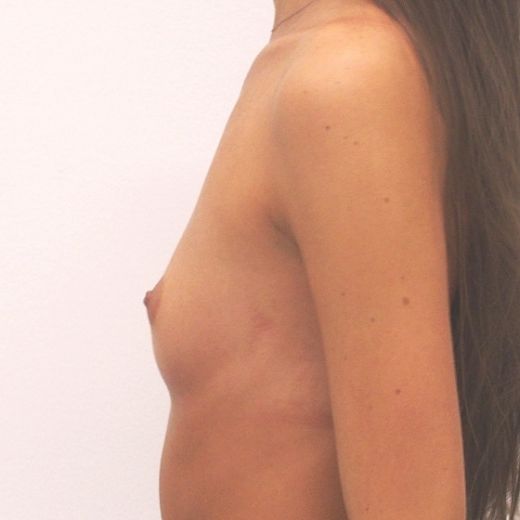 Image before