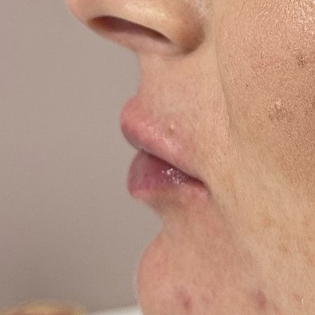Image after