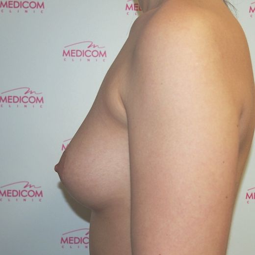 Image before