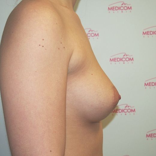 Image before