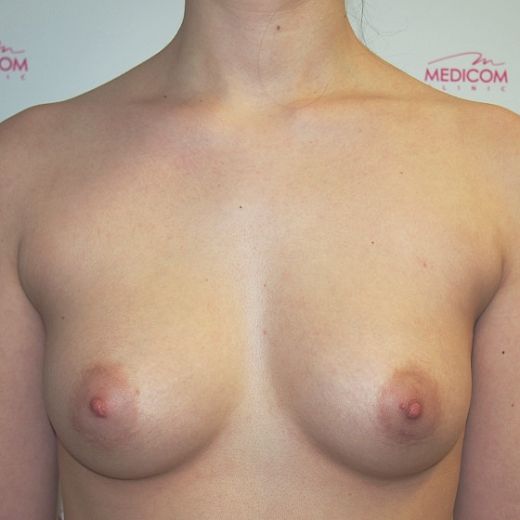 Image before