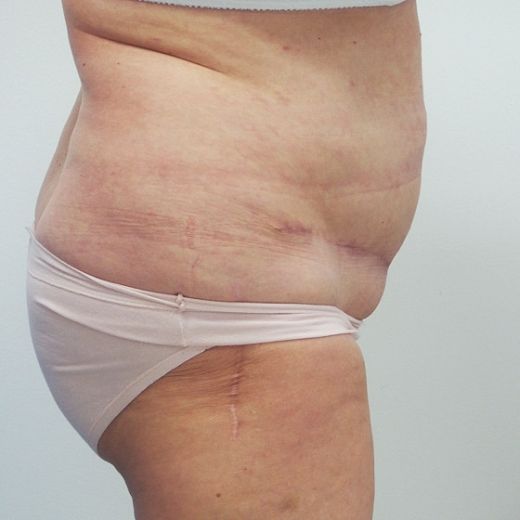 Image after