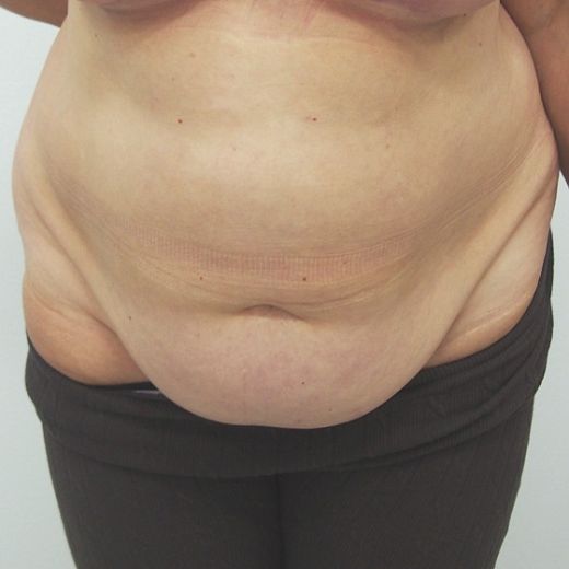 Image before