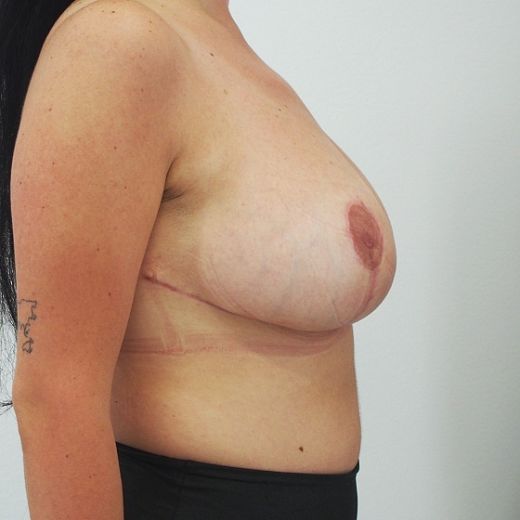 Image after