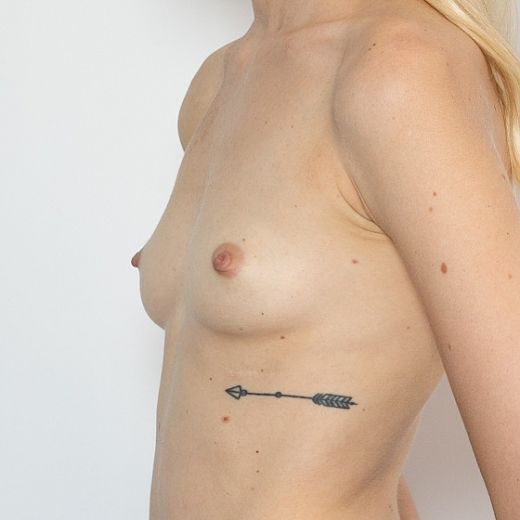 Image before