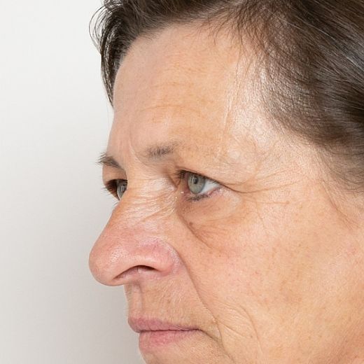Image before