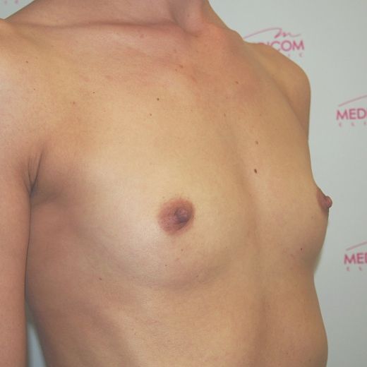 Image before