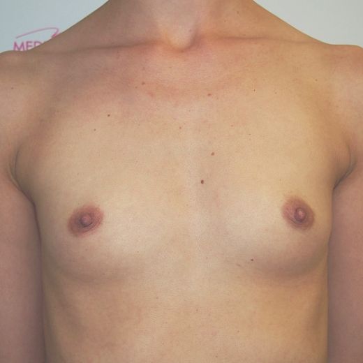 Image before