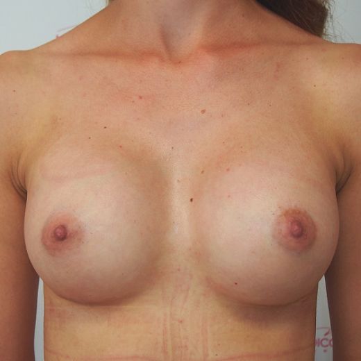 Image after