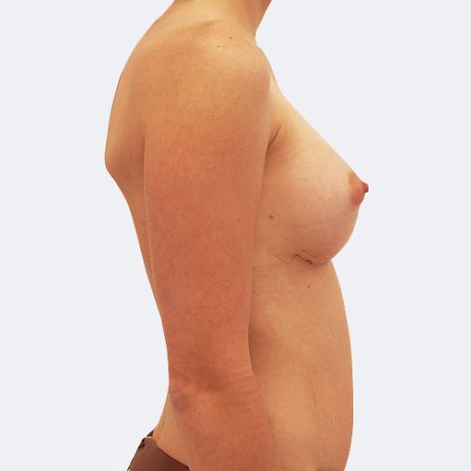 Image after