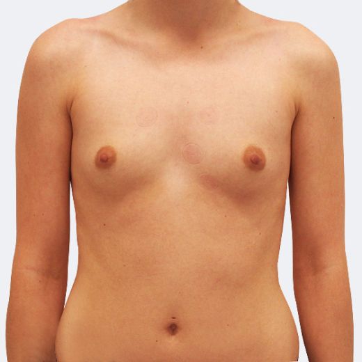 Image before