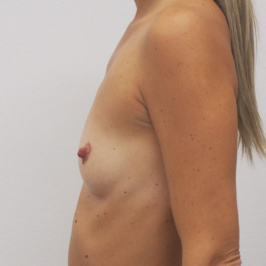 Image before