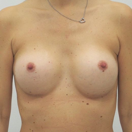 Image after