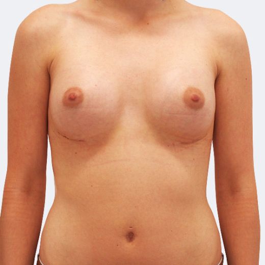 Image after