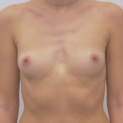 Image before