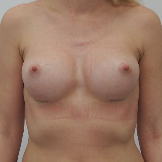 Image after