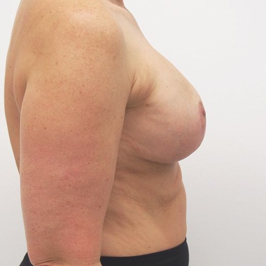 Image after
