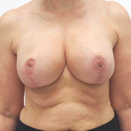 Image after