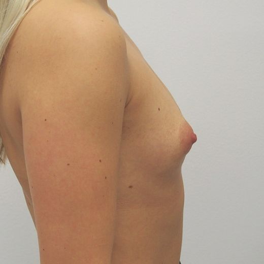 Image before