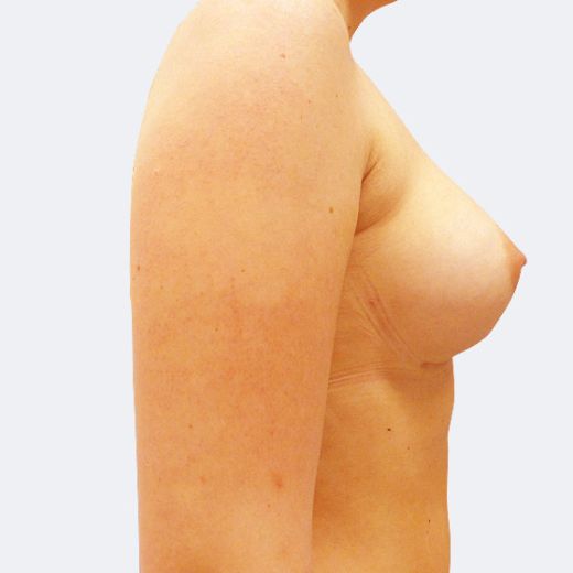 Image after
