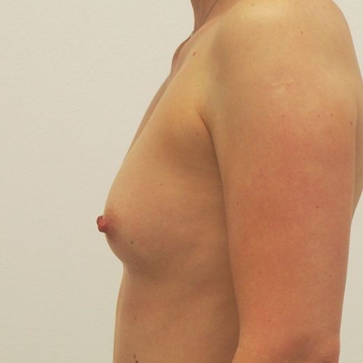 Image before