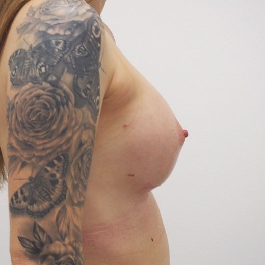 Image after