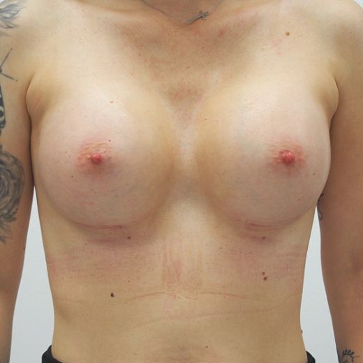 Image after