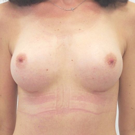 Image after