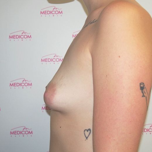 Image before