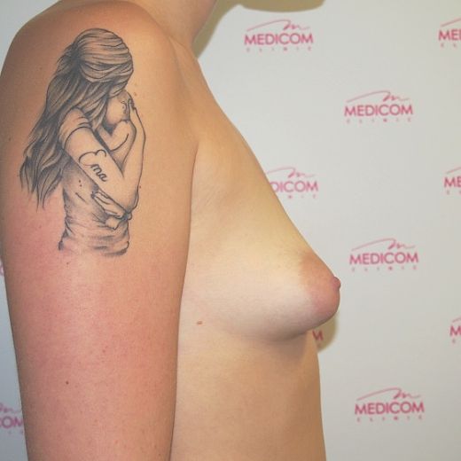 Image before