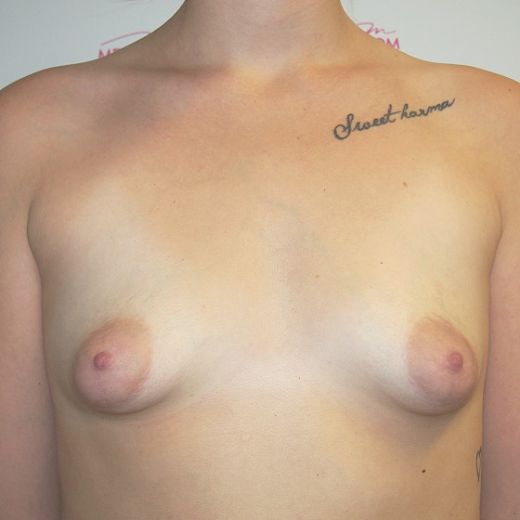Image before