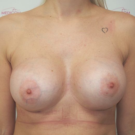 Image after