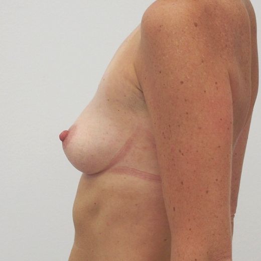 Image before